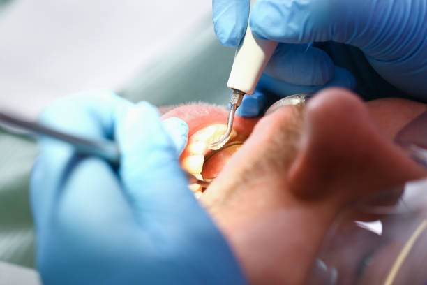 Best Mobile Emergency Dentist in Hope Mills, NC